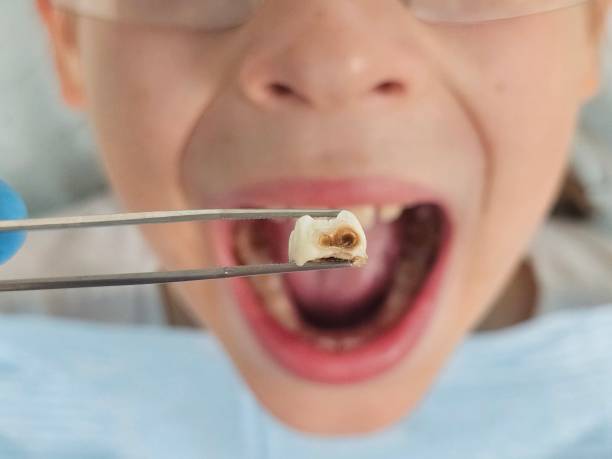 Best Emergency Dental Services for Seniors in Gary, IN